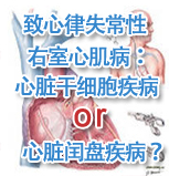 [AHA2012]致心律失常性右室心肌病：心脏干细胞疾病 or 心脏闰盘疾病？
